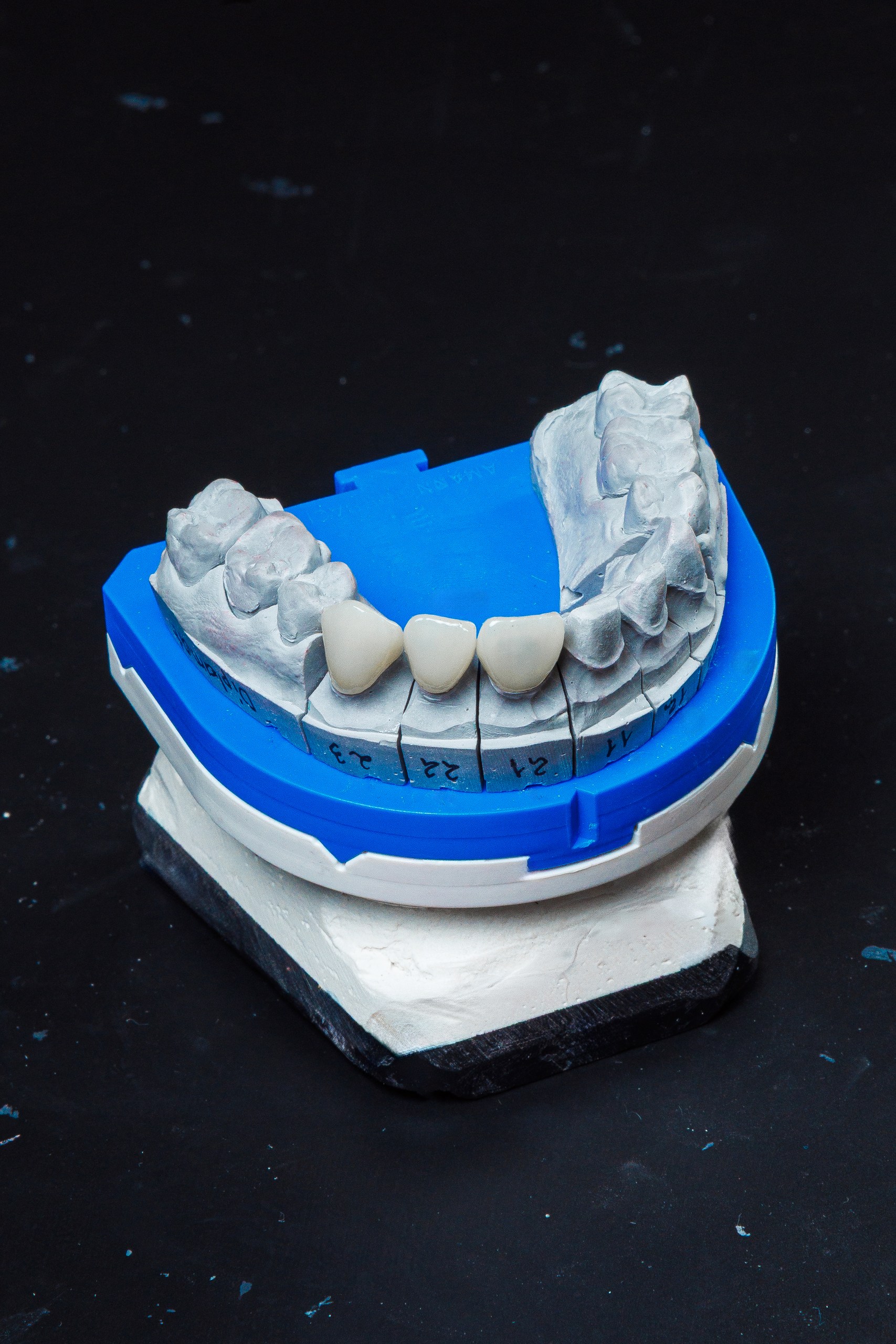 Zirconiu Full Anatomic