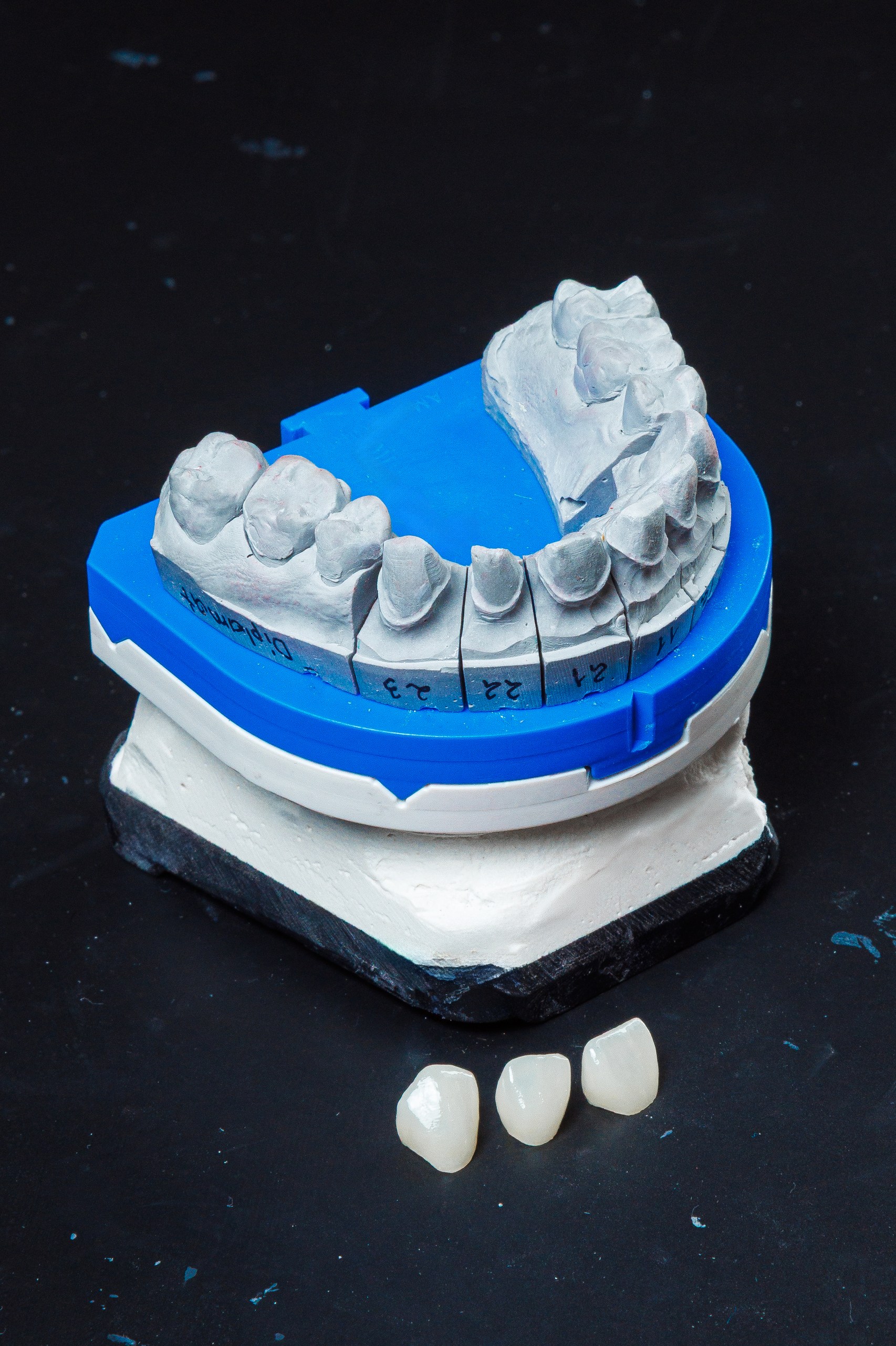 Fațete CAD Full Anatomic