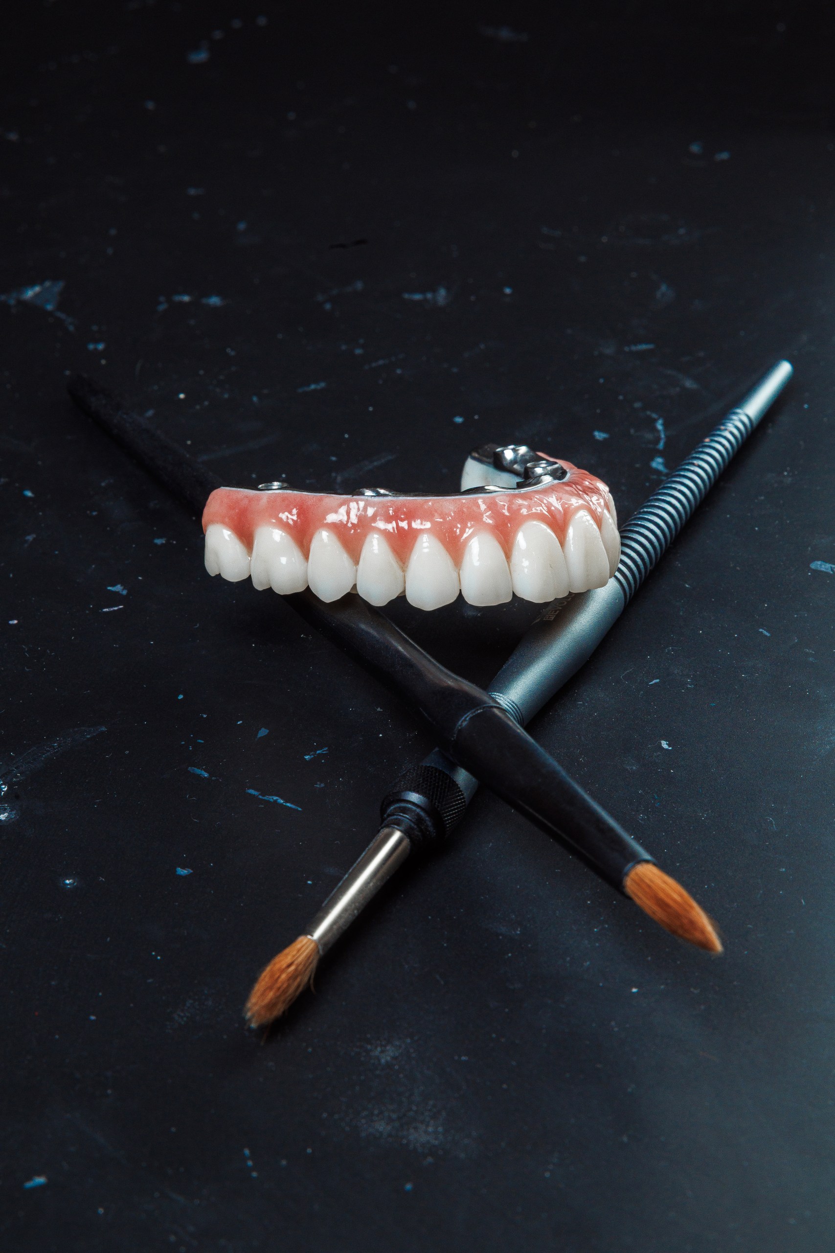 Fațete CAD Stratificate