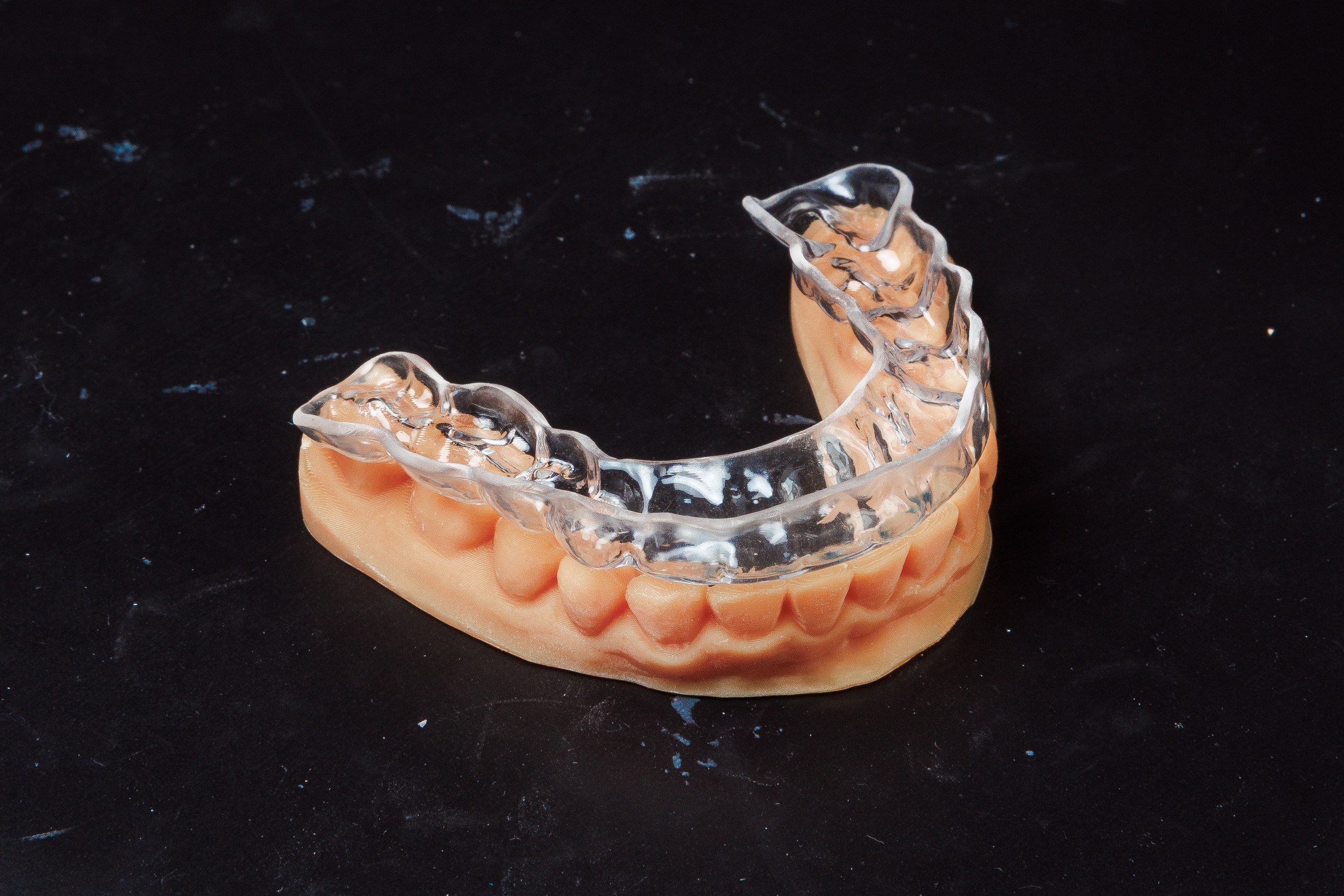 Gutieră transparentă