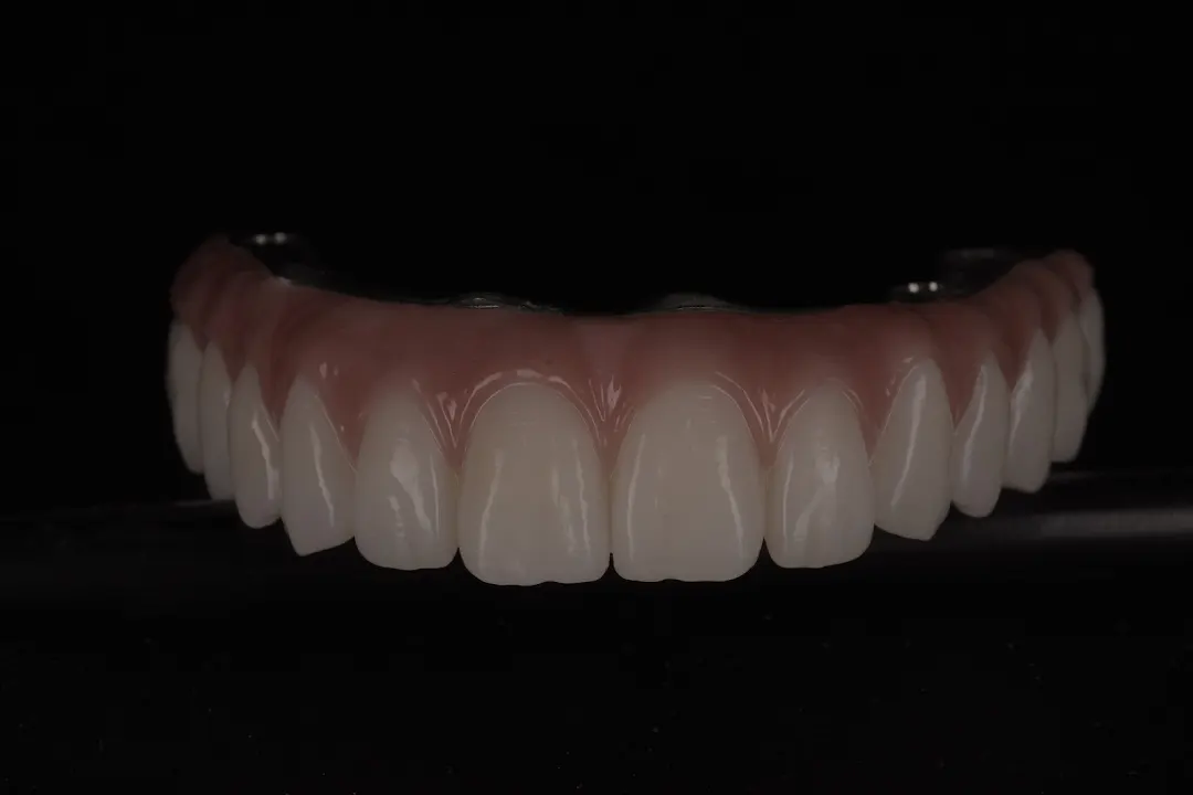 Lucrări pe Implant
